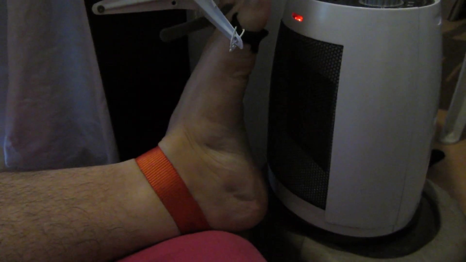 Tortured foot roasted by heating after bastinado and falaka - Recessed vulva self correct after heat