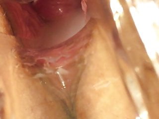 Wife speculum in pussy cervix 5...