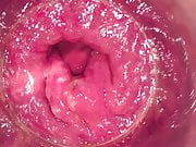 Pink rectum Dec-13-2018