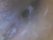 mcasshole1
