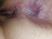 Wife's gaping asshole.